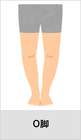 O脚